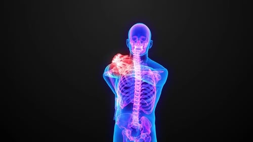 Pain and injury in the Trapezius muscles