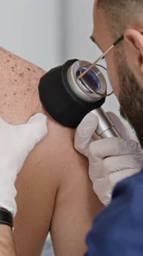 Hands of Doctor Inspecting Skin Rash with Dermatoscope
