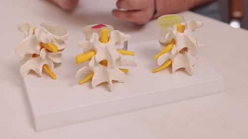 Modelos de columna vertebral Modelo anatómico de vértebras