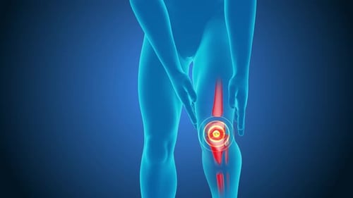 3D Medical Illustration of Human Knee Joint Pain
