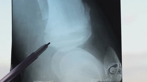 Enfermedades ortopédicas