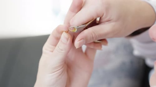 A woman bites off the skin from her finger with manicure tweezers, close-up.