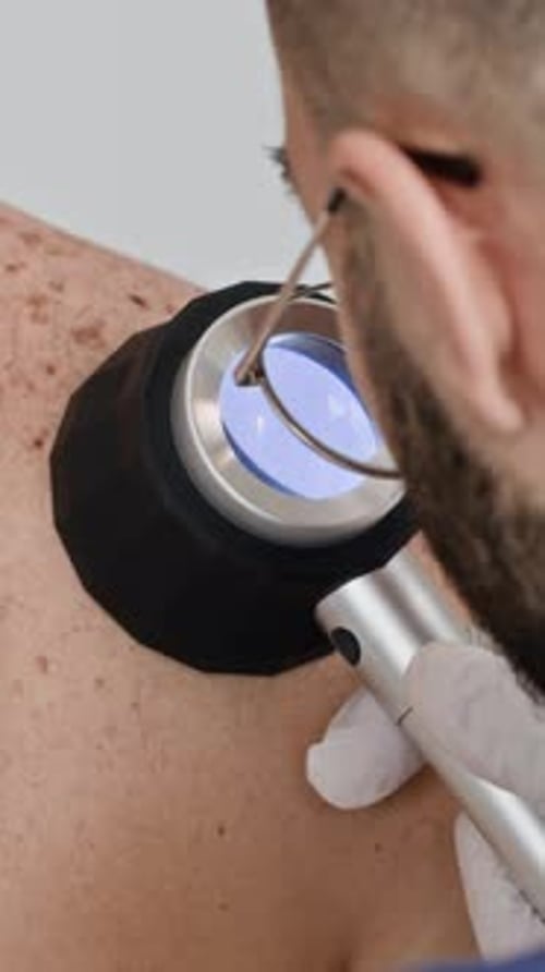 Vertical of Doctor Inspecting Skin Condition with Dermatoscope