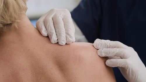 Hands of Dermatologist Examining Patients Moles on Shoulders