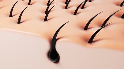 Skin with hair in pores, hair treatment concept