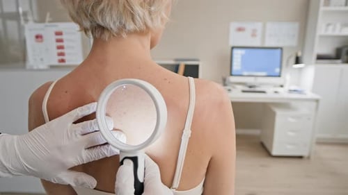 Hands of Doctor Examining Skin on Patients Back through Magnifying Glass