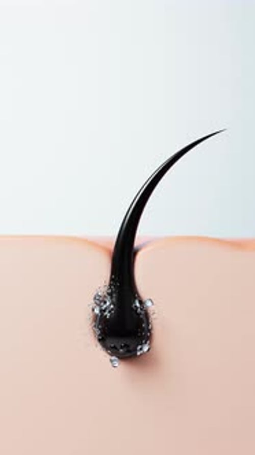 Skin with hair in pores, hair treatment concept