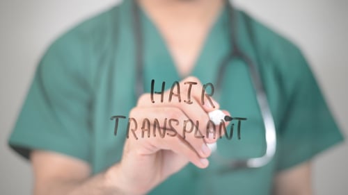 Trasplante de cabello