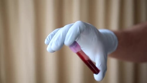 Imágenes de vídeo del médico: muestras de sangre colocadas en tubos de muestras