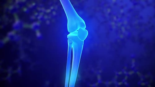 Radiografía de esqueleto de rodilla